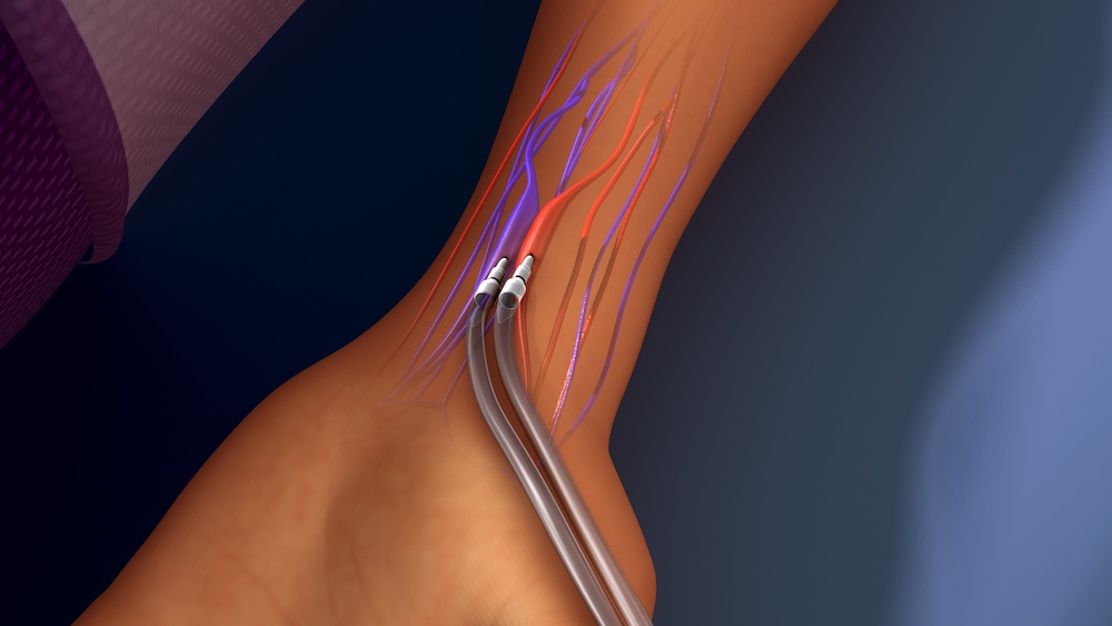 Hemodialysis Menu Tile